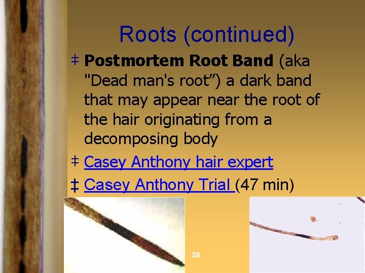 Roots (continued) ‡ Postmortem Root Band (aka "Dead man's root”) a dark band that