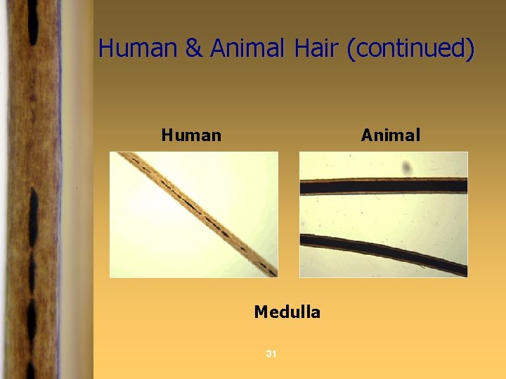 Human & Animal Hair (continued) Human Animal Medulla 31 