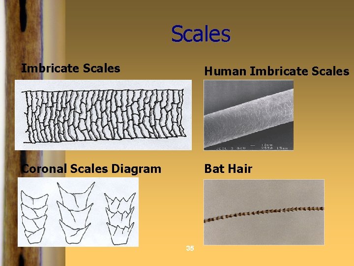 Scales Imbricate Scales Human Imbricate Scales Coronal Scales Diagram Bat Hair 35 