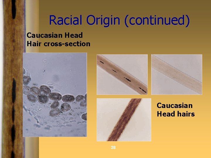 Racial Origin (continued) Caucasian Head Hair cross-section Caucasian Head hairs 38 