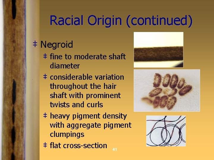 Racial Origin (continued) ‡ Negroid ‡ fine to moderate shaft diameter ‡ considerable variation