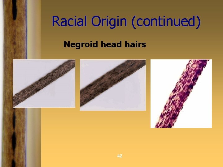 Racial Origin (continued) Negroid head hairs 42 