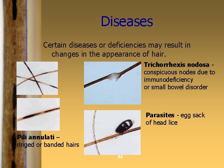 Diseases Certain diseases or deficiencies may result in changes in the appearance of hair.
