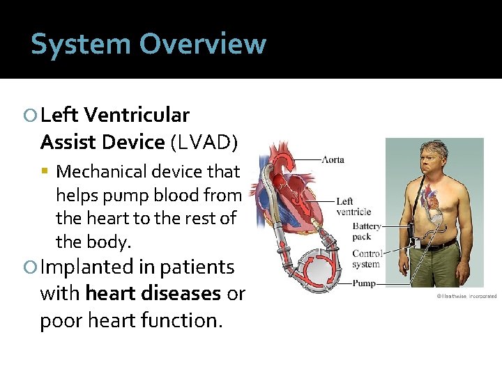 System Overview Left Ventricular Assist Device (LVAD) Mechanical device that helps pump blood from