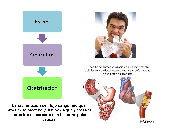 Estrés Cigarrillos Cicatrización La disminución del flujo sanguíneo que produce la nicotina y la