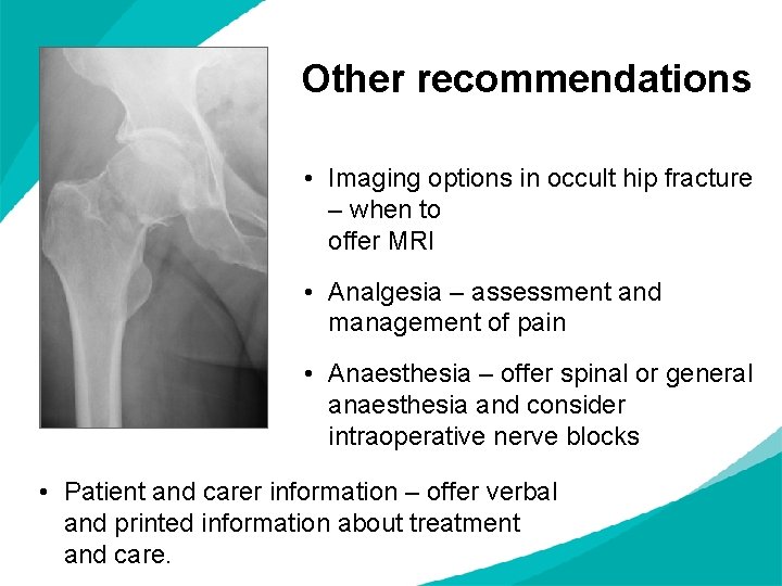 Other recommendations • Imaging options in occult hip fracture – when to offer MRI