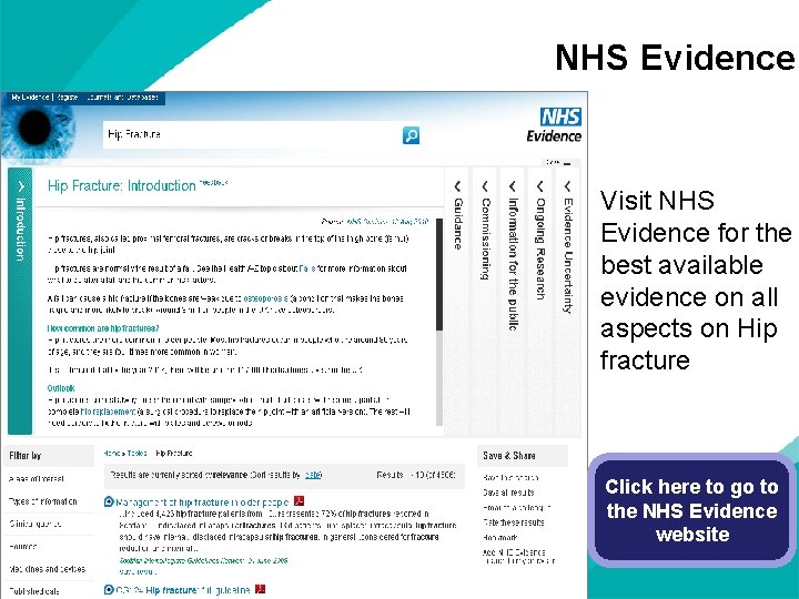NHS Evidence Visit NHS Evidence for the best available evidence on all aspects on
