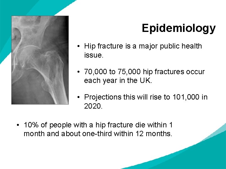 Epidemiology • Hip fracture is a major public health issue. • 70, 000 to