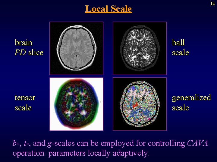 14 Local Scale brain PD slice ball scale tensor scale generalized scale b-, t-,