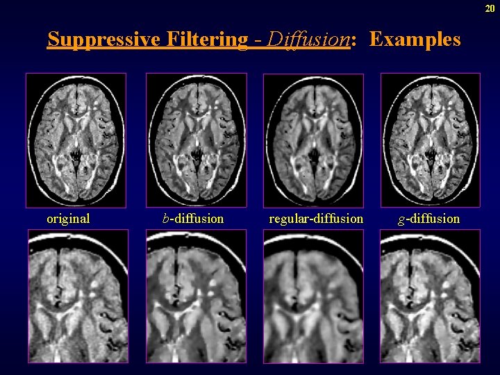 20 Suppressive Filtering - Diffusion: Examples original b-diffusion regular-diffusion g-diffusion 
