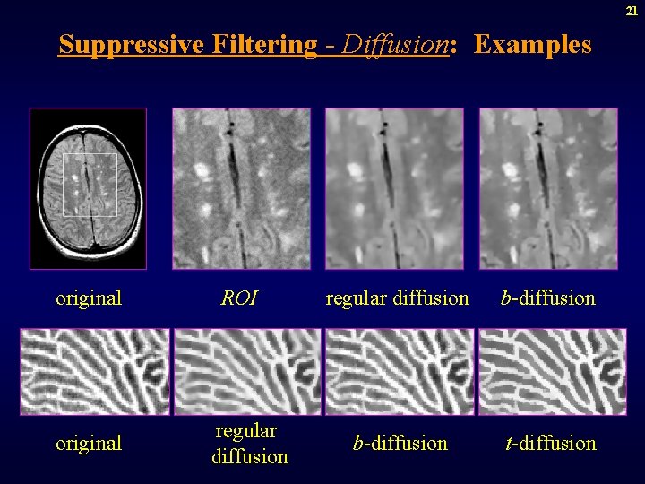 21 Suppressive Filtering - Diffusion: Examples original ROI regular diffusion b-diffusion t-diffusion 