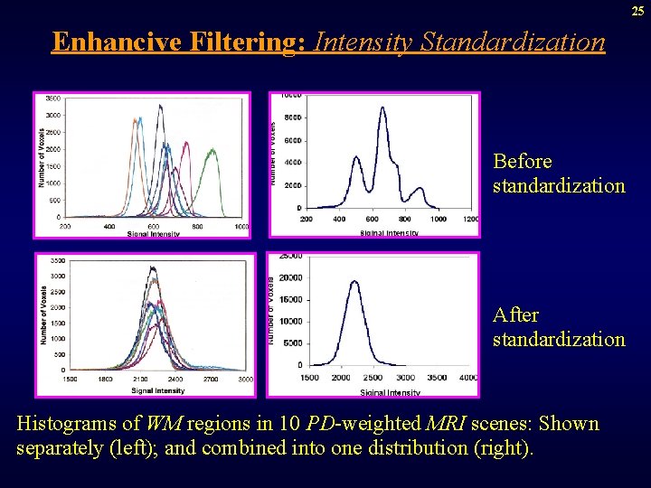 25 Enhancive Filtering: Intensity Standardization Before standardization After standardization Histograms of WM regions in