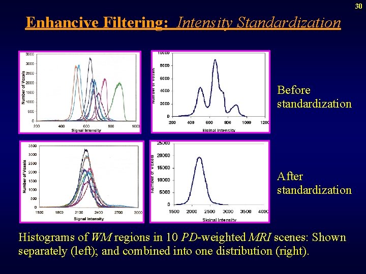 30 Enhancive Filtering: Intensity Standardization Before standardization After standardization Histograms of WM regions in