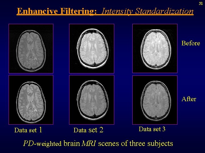31 Enhancive Filtering: Intensity Standardization Before After Data set 1 Data set 2 Data