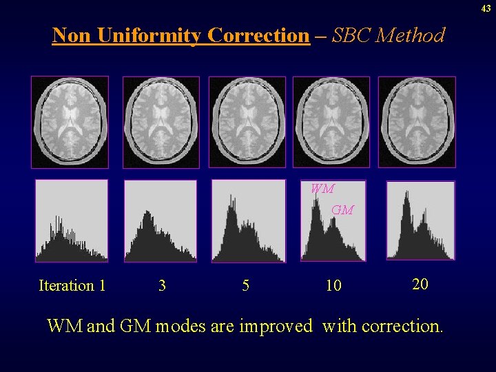 43 Non Uniformity Correction – SBC Method WM GM Iteration 1 3 5 10