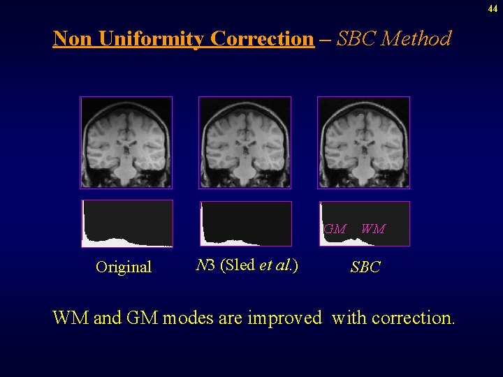 44 Non Uniformity Correction – SBC Method GM Original N 3 (Sled et al.