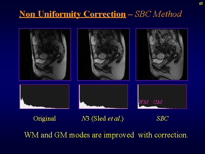 45 Non Uniformity Correction – SBC Method WM GM Original N 3 (Sled et