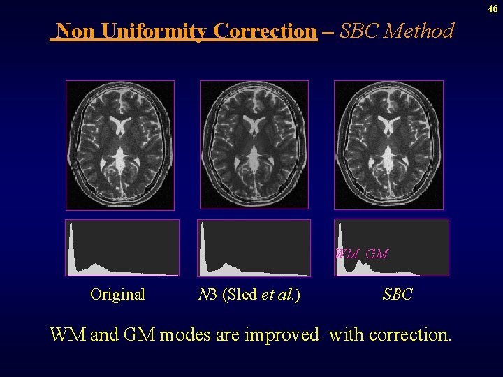 46 Non Uniformity Correction – SBC Method WM GM Original N 3 (Sled et