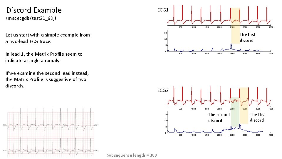 Discord Example ECG 1 (macecgdb/test 21_90 j) 500 Let us start with a simple