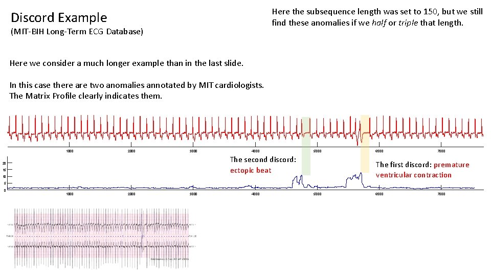 Here the subsequence length was set to 150, but we still find these anomalies