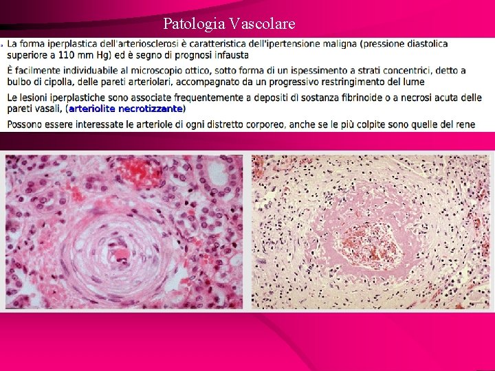 Patologia Vascolare 