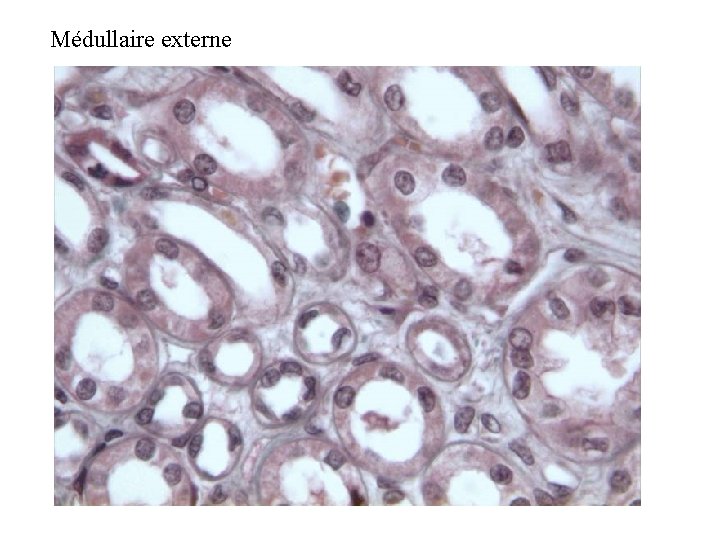 Médullaire externe 