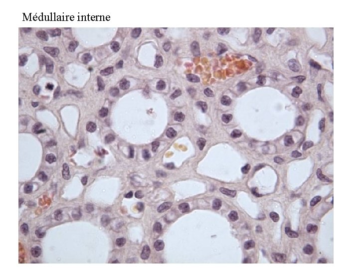 Médullaire interne 