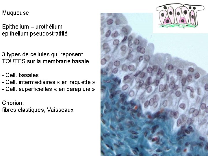 Muqueuse Epithelium = urothélium epithelium pseudostratifié 3 types de cellules qui reposent TOUTES sur