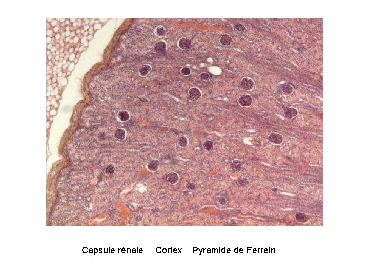 Capsule rénale Cortex Pyramide de Ferrein 