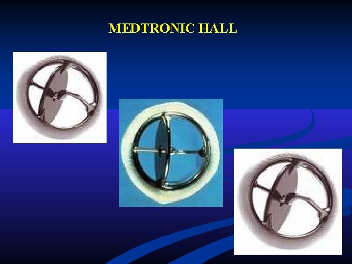 MEDTRONIC HALL MEDTRONIC HALL