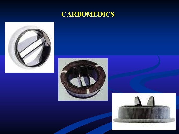 CARBOMEDICS CARBOMEDICS