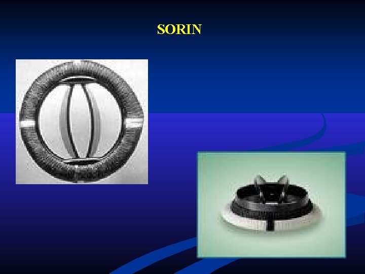 SORIN SORIN