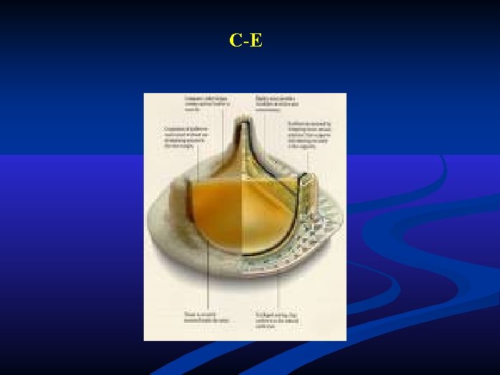 C-E C-E