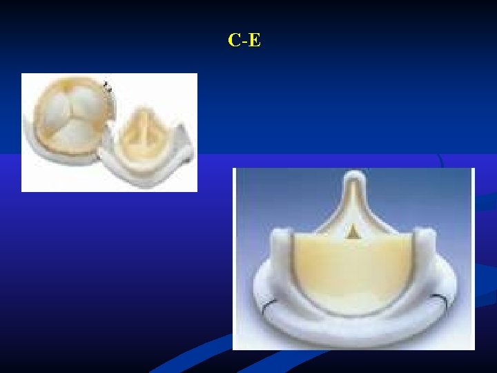 C-E C-E