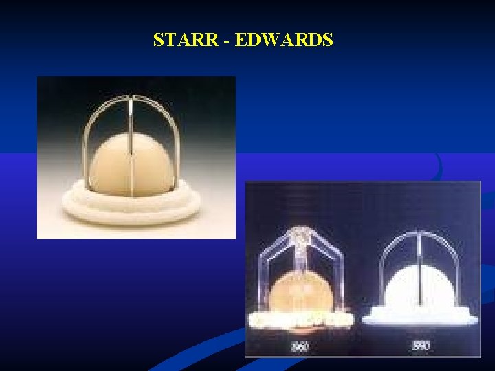 STARR - EDWARDS STARR - EDWARDS
