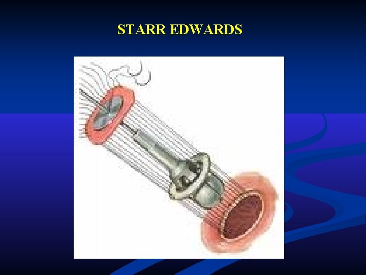 STARR EDWARDS STARR EDWARDS