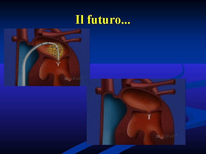 Il futuro. . . Il futuro. . .