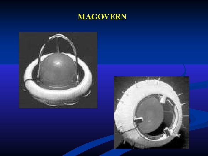 MAGOVERN MAGOVERN
