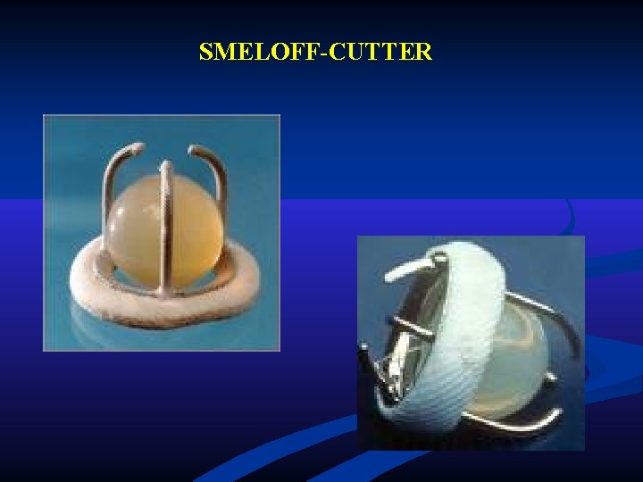 SMELOFF-CUTTER SMELOFF-CUTTER