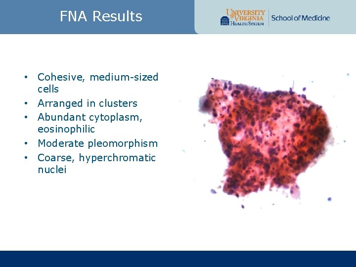 FNA Results • Cohesive, medium-sized cells • Arranged in clusters • Abundant cytoplasm, eosinophilic