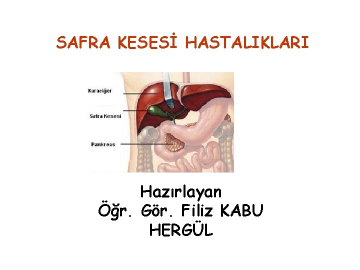 SAFRA KESESİ HASTALIKLARI Hazırlayan Öğr. Gör. Filiz KABU HERGÜL 