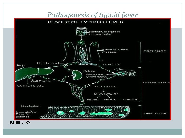 Pathogenesis of typoid fever SUMBER : UKM 