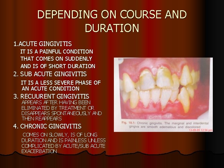 DEPENDING ON COURSE AND DURATION 1. ACUTE GINGIVITIS IT IS A PAINFUL CONDITION THAT