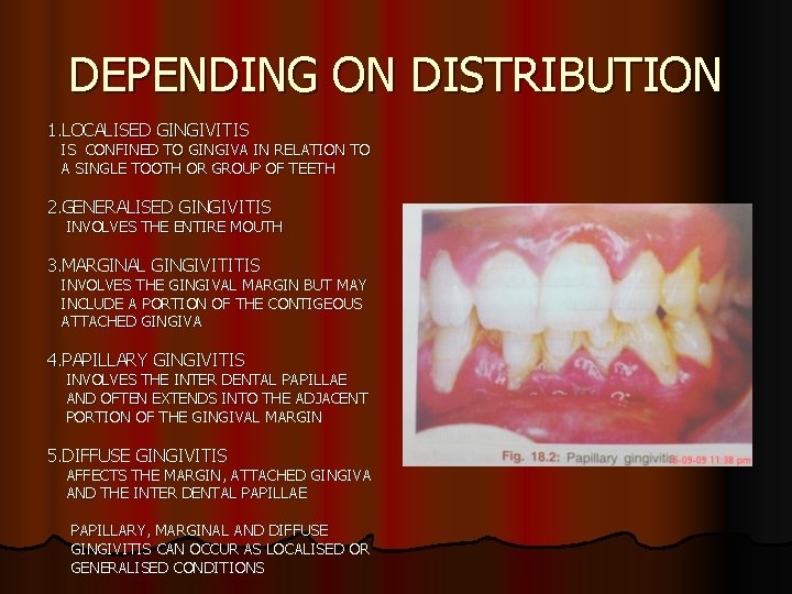 DEPENDING ON DISTRIBUTION 1. LOCALISED GINGIVITIS IS CONFINED TO GINGIVA IN RELATION TO A
