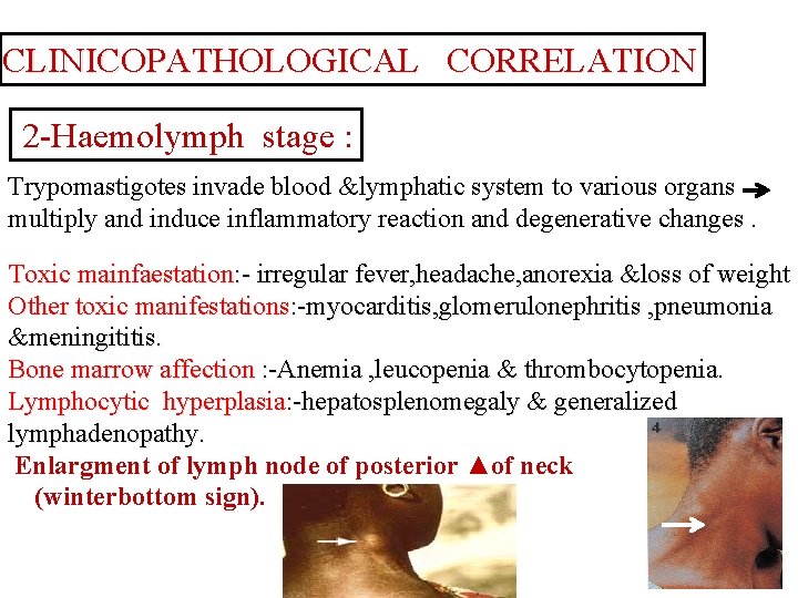 CLINICOPATHOLOGICAL CORRELATION 2 -Haemolymph stage : Trypomastigotes invade blood &lymphatic system to various organs