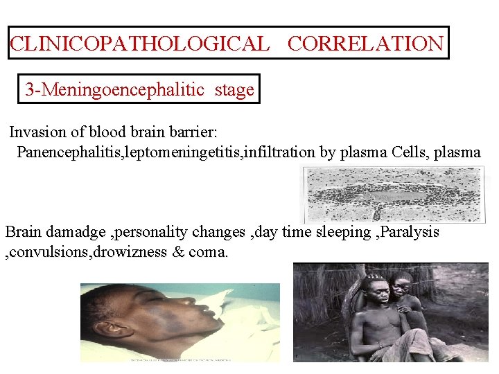 CLINICOPATHOLOGICAL CORRELATION 3 -Meningoencephalitic stage Invasion of blood brain barrier: Panencephalitis, leptomeningetitis, infiltration by