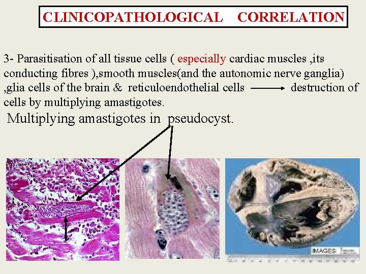 CLINICOPATHOLOGICAL CORRELATION 3 - Parasitisation of all tissue cells ( especially cardiac muscles ,