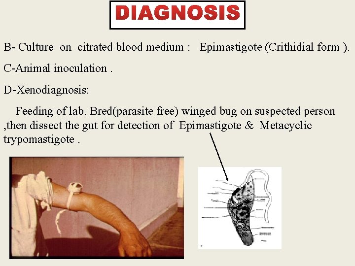 B- Culture on citrated blood medium : Epimastigote (Crithidial form ). C-Animal inoculation. D-Xenodiagnosis: