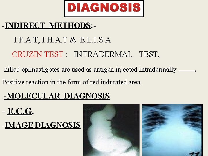 -INDIRECT METHODS: I. F. A. T, I. H. A. T & E. L. I.