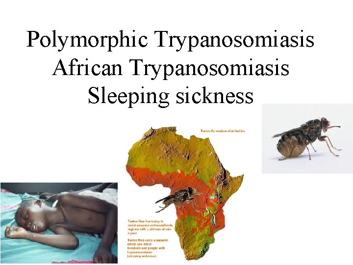 Polymorphic Trypanosomiasis African Trypanosomiasis Sleeping sickness 